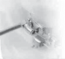 Closed Arm Bending Distal 1
